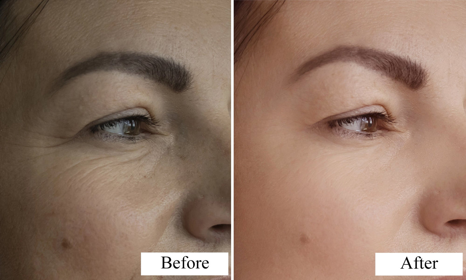 LED Light Therapy Face Mask for At-Home Skin Rejuvenation