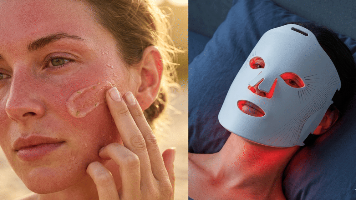 After Sun Skin Repair: The Science Behind Red Light Therapy for Sunburn and UV Damage Recovery
