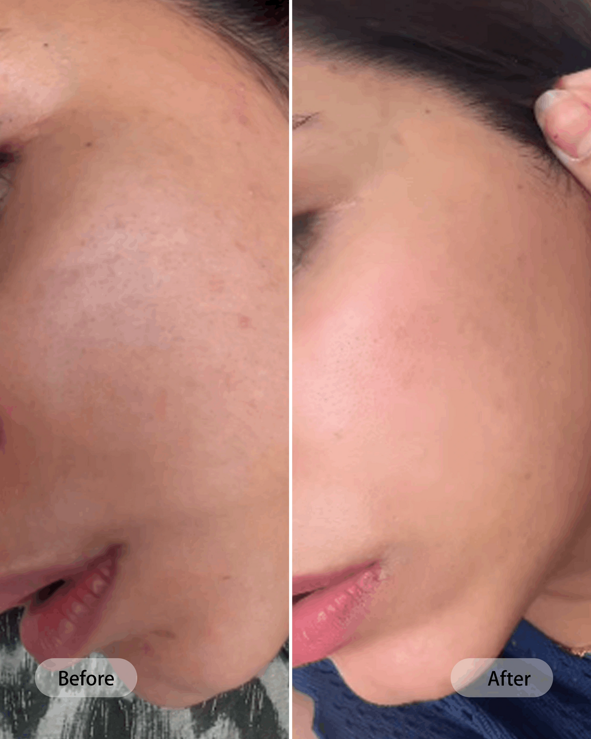 Umitec Before & After Influencer 11