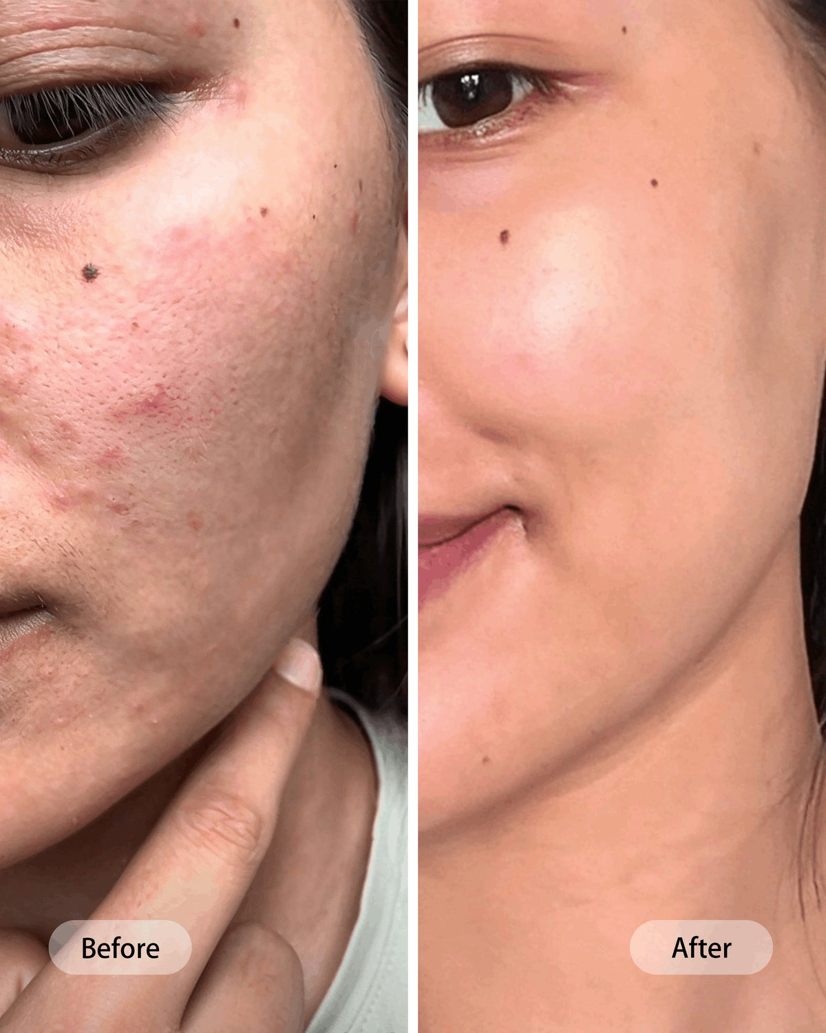 Umitec Before & After influencer 19