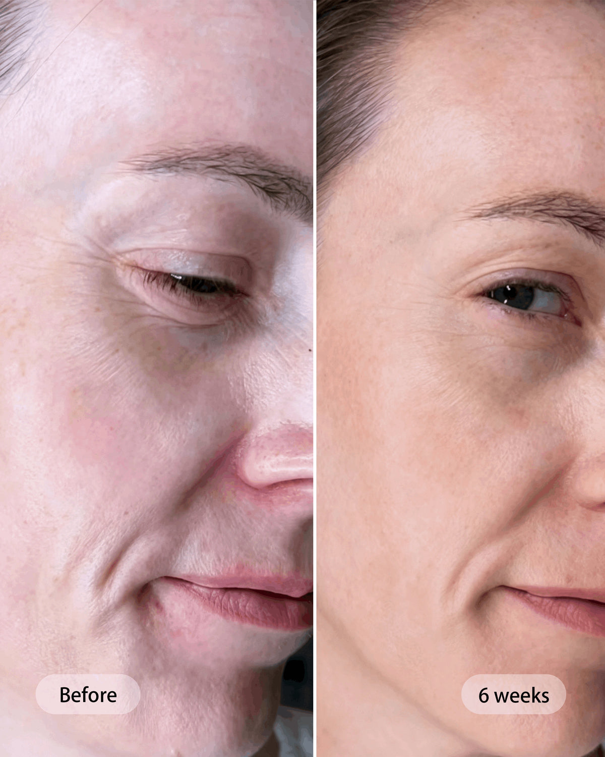 Umitec Before & After Influencer 2