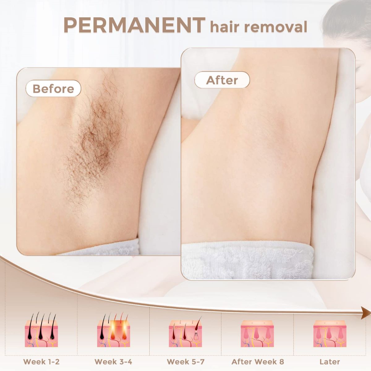 LVARA IPL Hair Removal Device