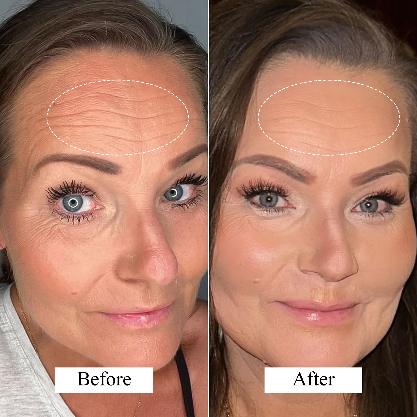customer review-"I have noticed a significant reduction in the wrinkles around my eyes and mouth after using the mask. My skin feels smoother and looks much firmer."