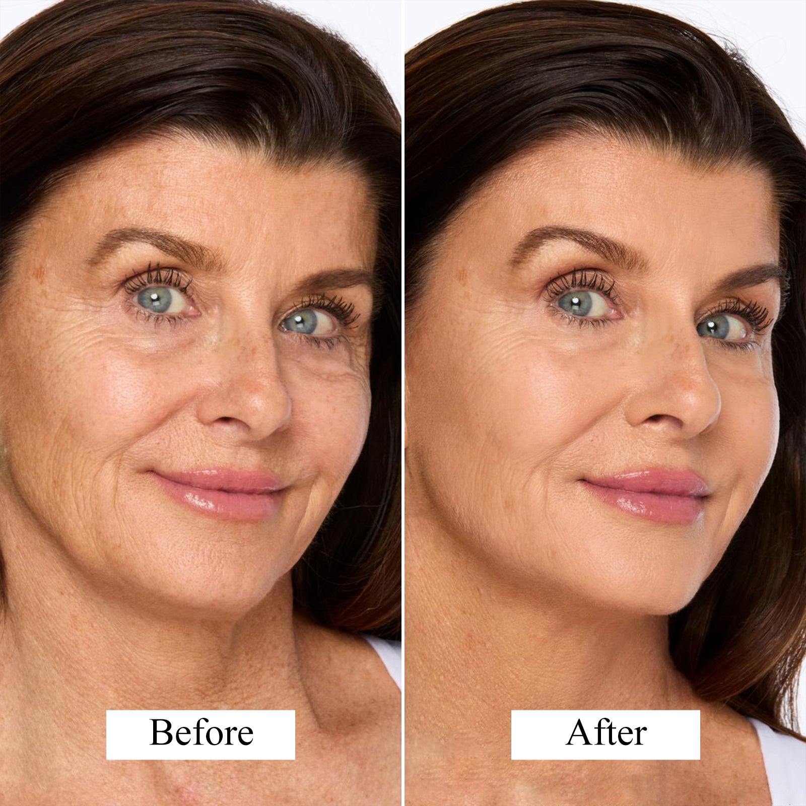 customer review-"I had fine lines and sun spots that were starting to show. After using the mask for a few weeks, I can already see those fine lines fading. My skin looks so much healthier."