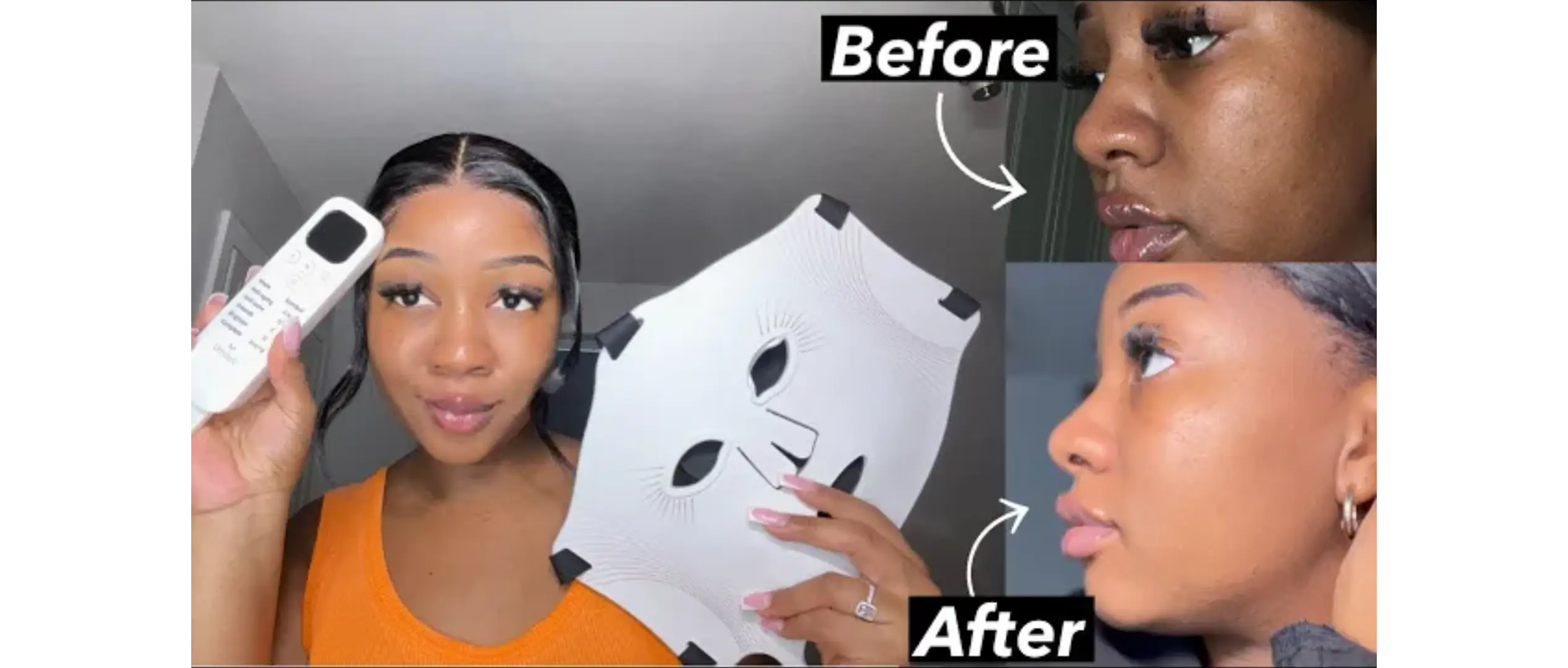 Umitec LED Therapy Face Mask: Redefining Your Skincare Routine for Radiant, Healthier Skin Umitec