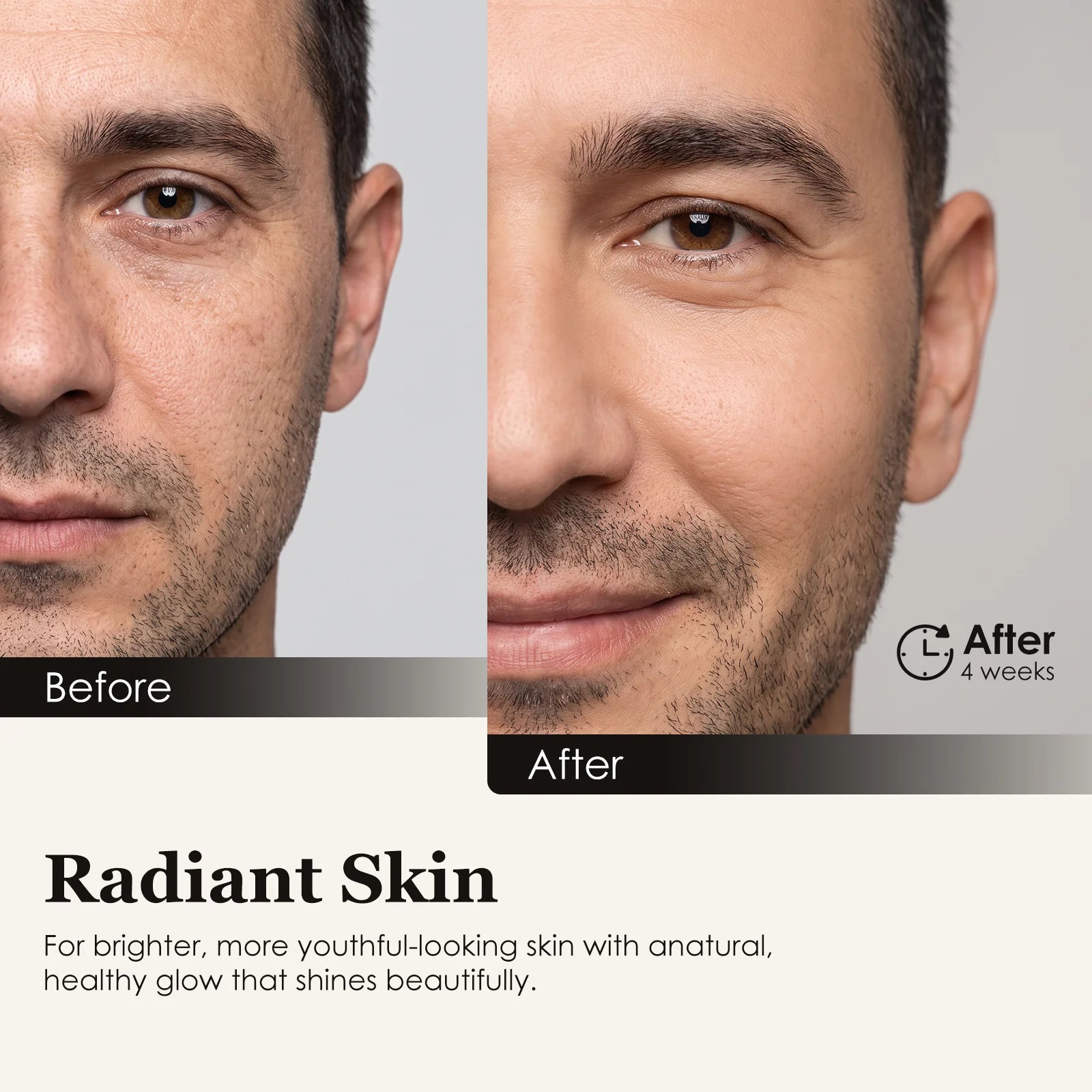 LED Light Therapy; Zonecraft; Red light therapy; Anti-aging; Anti-acne; Skincare; Skincare tools