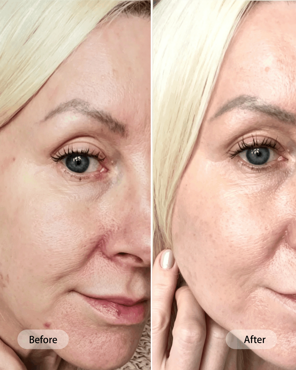 Umitec Before & After Influencer 10