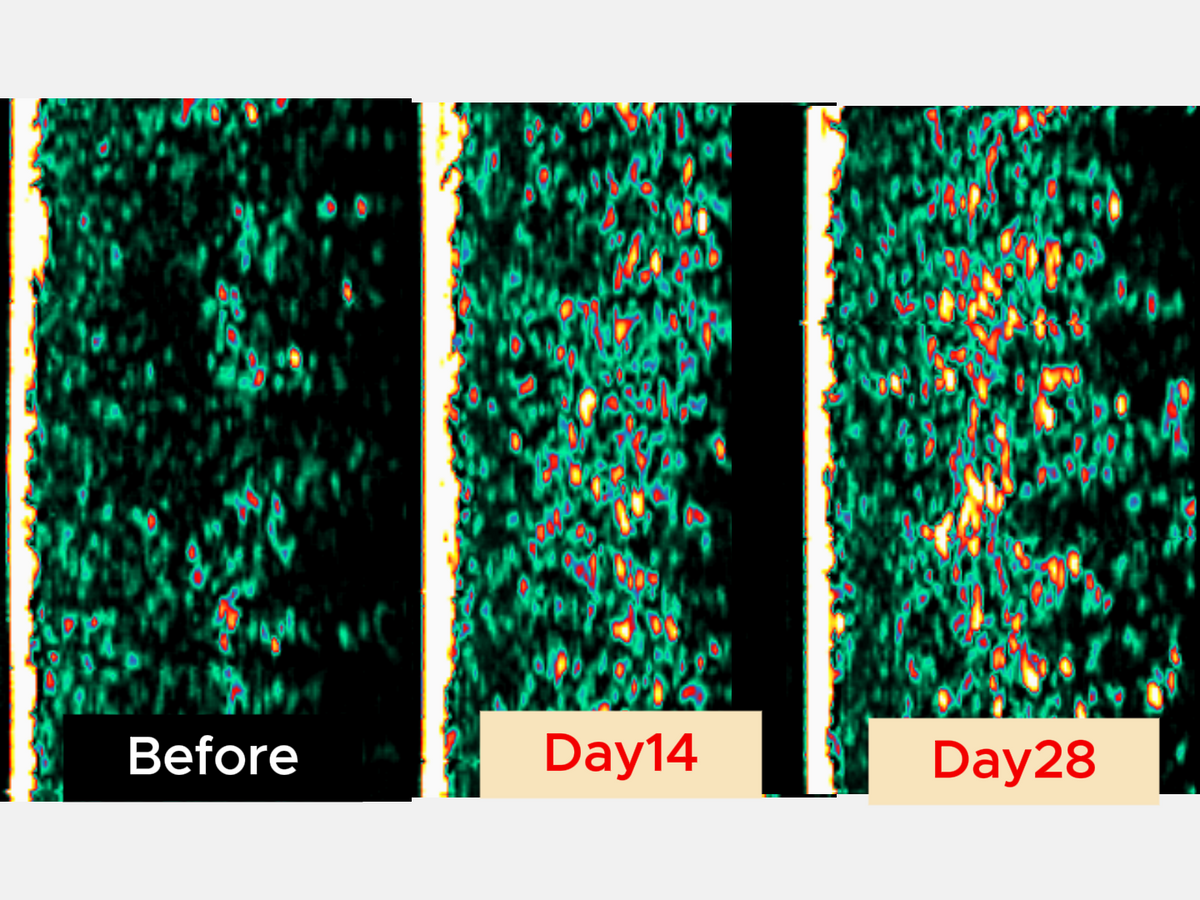 Ultrasound skin scans showing a progressive increase in collagen density after 14 and 28 days of using Umitec LED Mask, demonstrating stimulated collagen production for firmer skin.