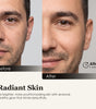 The before & After photos from real customer using Umitec Zonecraft LED Face Mask, results in radiant skin, brighter, youthful-looking, with a natural, healthy glow