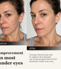 The before & After photos from real customer using Umitec Zonecraft LED Face Mask, mostly results in under eyes zones. See differences in 12-week clinical study with 31 subjects and 3 weeks use of 10-min treatment
